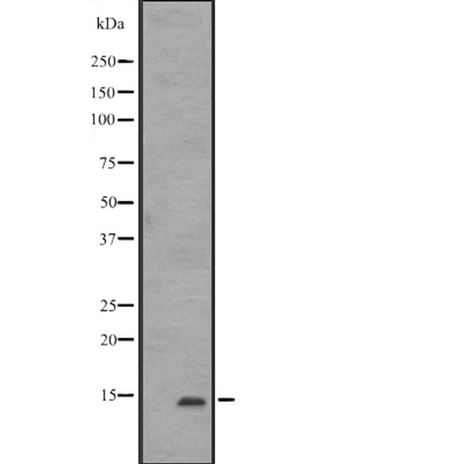 IFITM1 Antibody in Western Blot (WB)