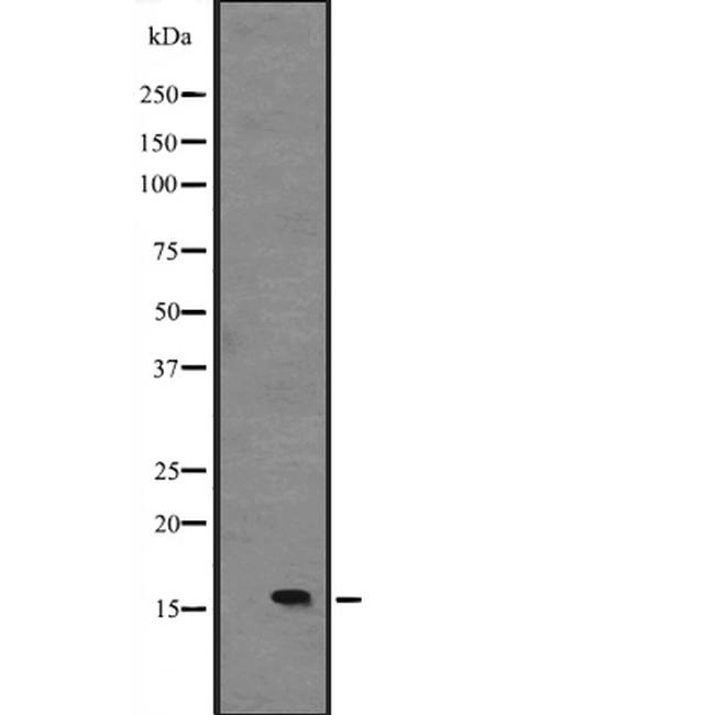 IL-15 Antibody in Western Blot (WB)