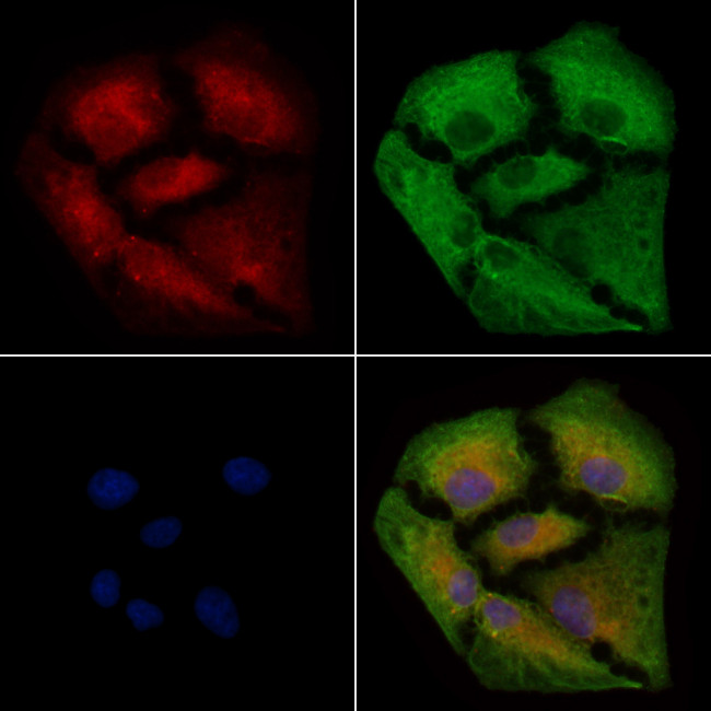 IL5RA (soluble) Antibody in Immunocytochemistry (ICC/IF)