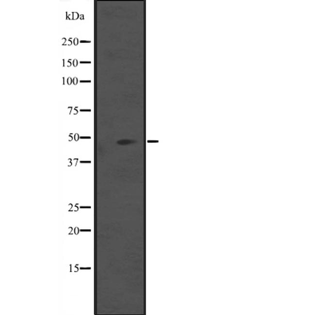 IL5RA (soluble) Antibody in Western Blot (WB)