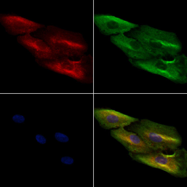 IL-9 Antibody in Immunocytochemistry (ICC/IF)