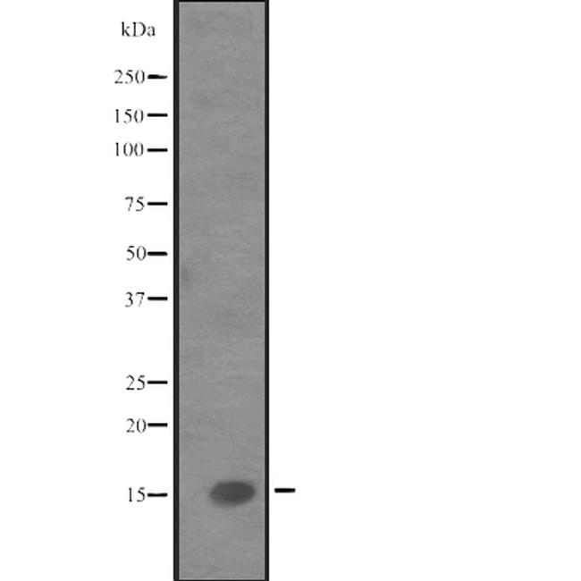 IL-9 Antibody in Western Blot (WB)