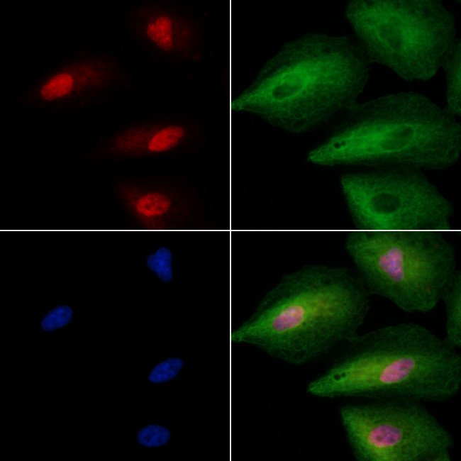 ING2 Antibody in Immunocytochemistry (ICC/IF)