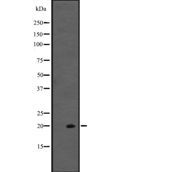 IL-20 Antibody in Western Blot (WB)