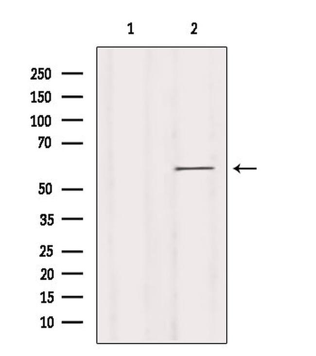 KCNN1 Antibody in Western Blot (WB)