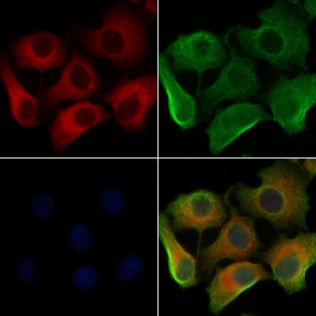 LAMTOR3 Antibody in Immunocytochemistry (ICC/IF)