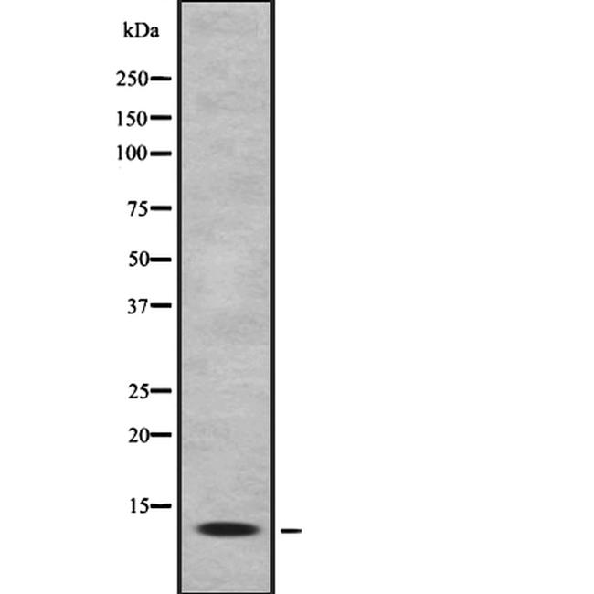 LAMTOR3 Antibody in Western Blot (WB)