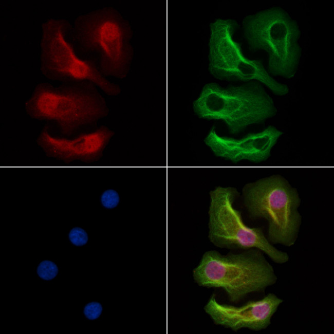 MAPK12 Antibody in Immunocytochemistry (ICC/IF)