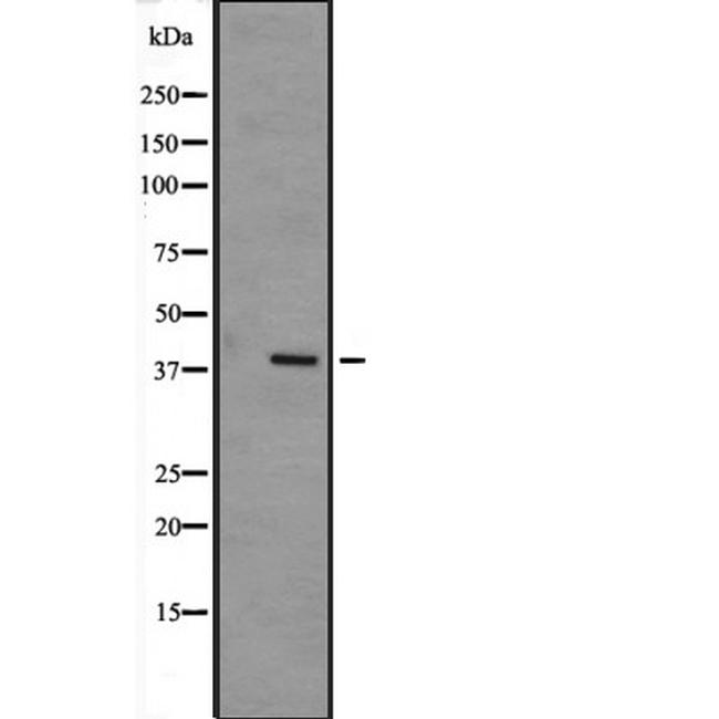 MAPK12 Antibody in Western Blot (WB)