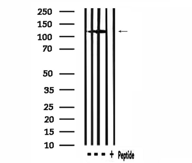 MSH3 Antibody in Western Blot (WB)