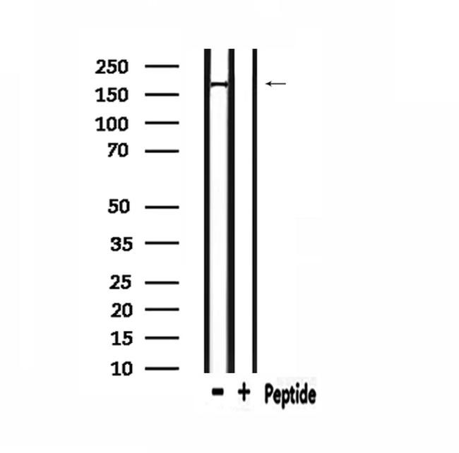 PIK3C2A Antibody in Western Blot (WB)