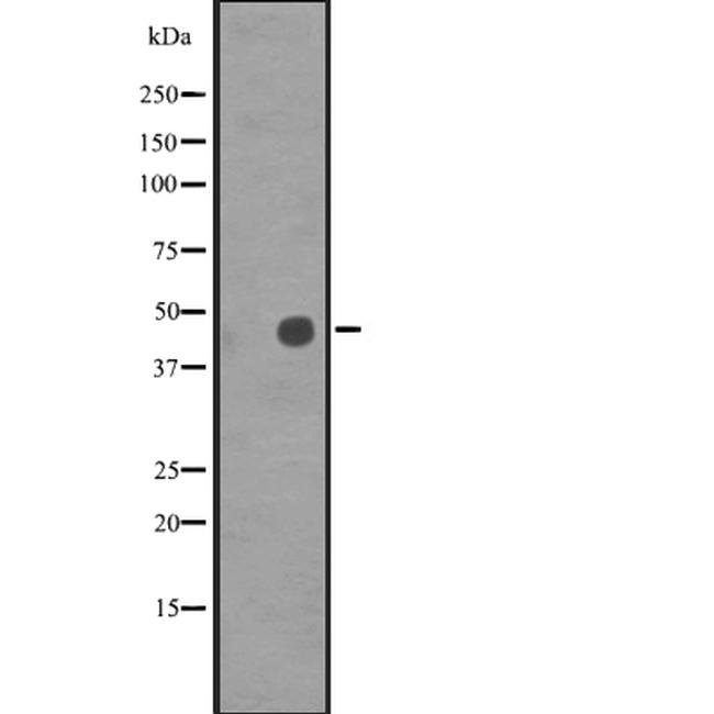 POU3F2 Antibody in Western Blot (WB)