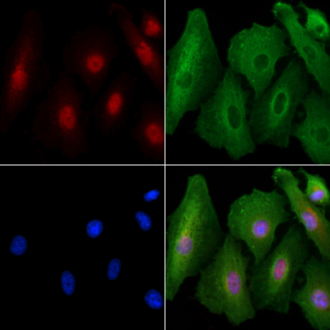 AMPK alpha-2 Antibody in Immunocytochemistry (ICC/IF)