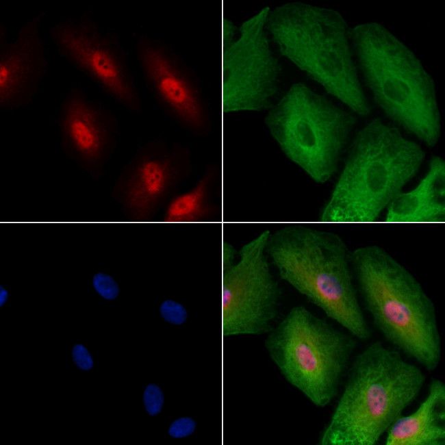 RAD1 Antibody in Immunocytochemistry (ICC/IF)