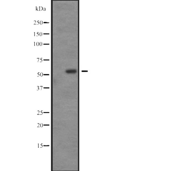 SGK3 Antibody in Western Blot (WB)