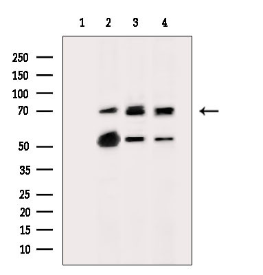 ST2 Antibody in Western Blot (WB)