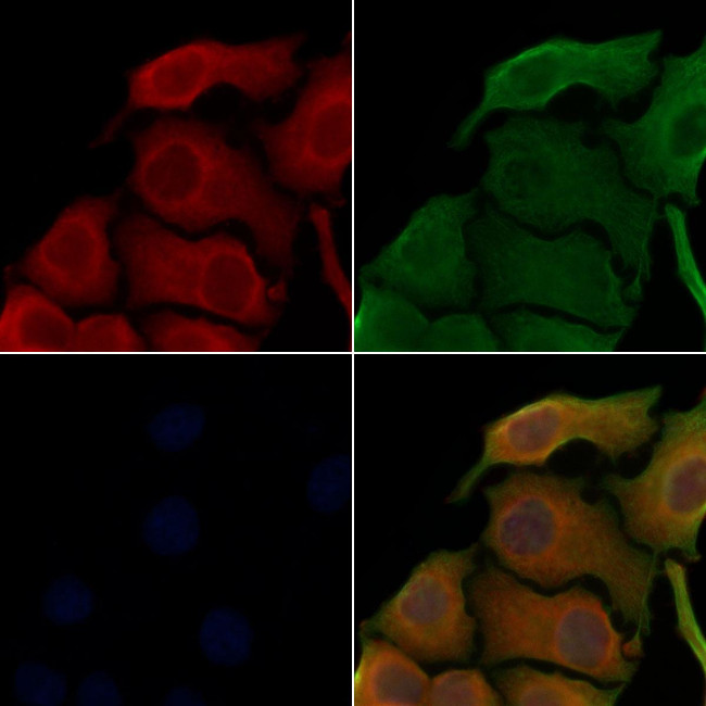 TAB2 Antibody in Immunocytochemistry (ICC/IF)