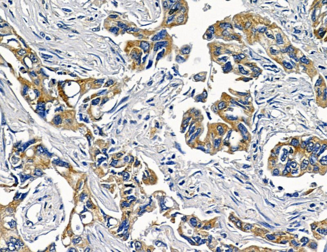 TAB2 Antibody in Immunohistochemistry (Paraffin) (IHC (P))