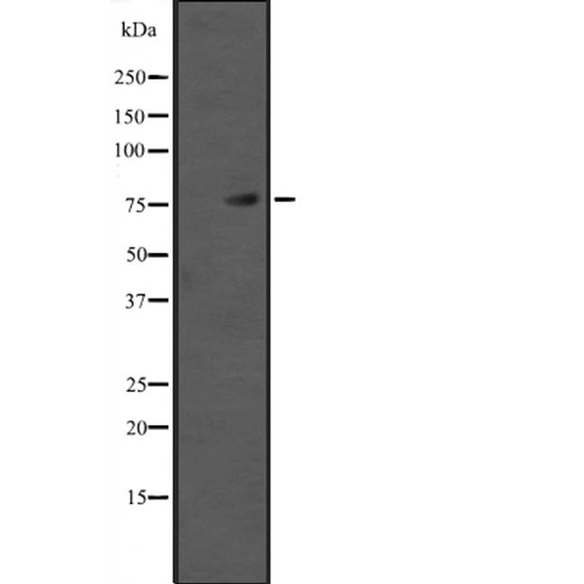 TAB2 Antibody in Western Blot (WB)