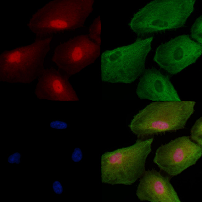 TAB3 Antibody in Immunocytochemistry (ICC/IF)