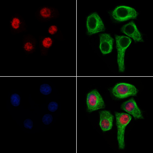 UBC3B Antibody in Immunocytochemistry (ICC/IF)