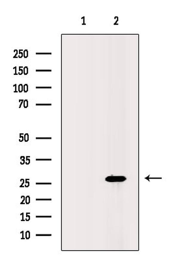 UBC3B Antibody in Western Blot (WB)