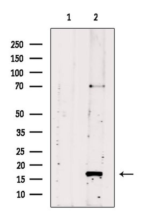 UBC3B Antibody in Western Blot (WB)