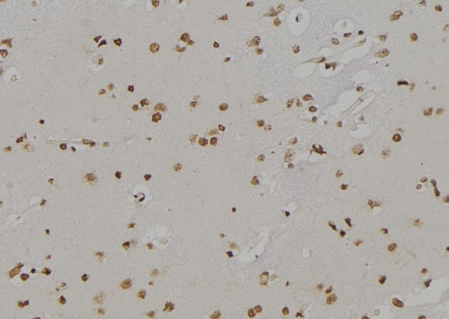 ALOX5 Antibody in Immunohistochemistry (Paraffin) (IHC (P))