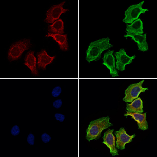 NCEH1 Antibody in Immunocytochemistry (ICC/IF)