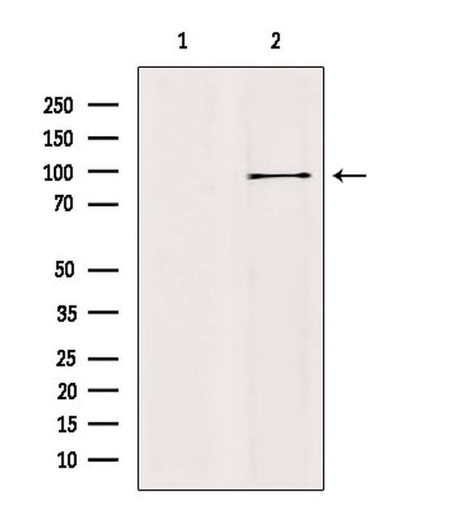 AAK1 Antibody in Western Blot (WB)