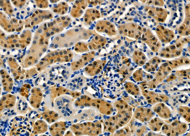 ABCB10 Antibody in Immunohistochemistry (Paraffin) (IHC (P))