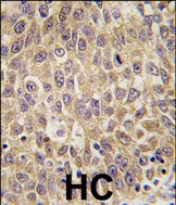 AFP Antibody in Immunohistochemistry (Paraffin) (IHC (P))