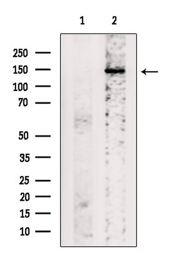 ABCB11 Antibody in Western Blot (WB)