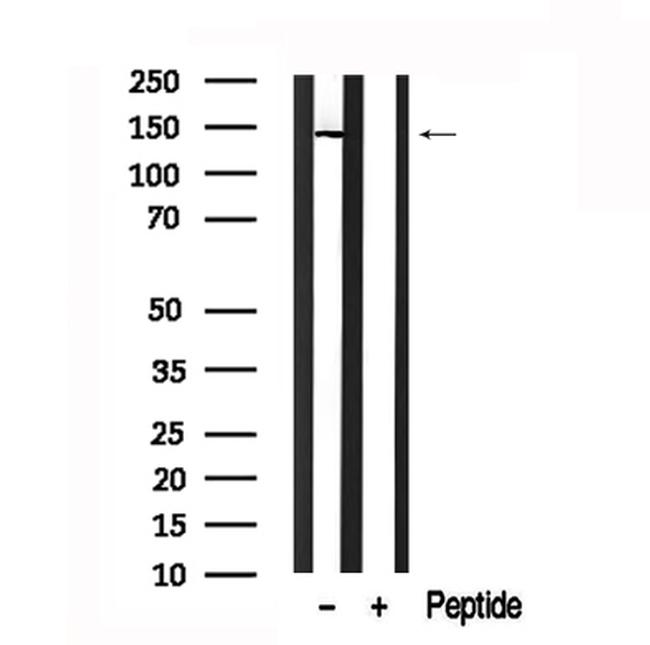 ABCB11 Antibody in Western Blot (WB)