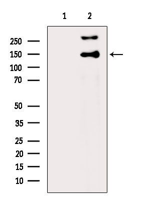 ABCB11 Antibody in Western Blot (WB)