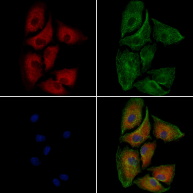 ABCB5 Antibody in Immunocytochemistry (ICC/IF)