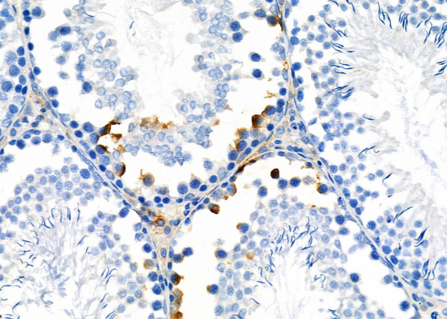 MRP1 Antibody in Immunohistochemistry (Paraffin) (IHC (P))