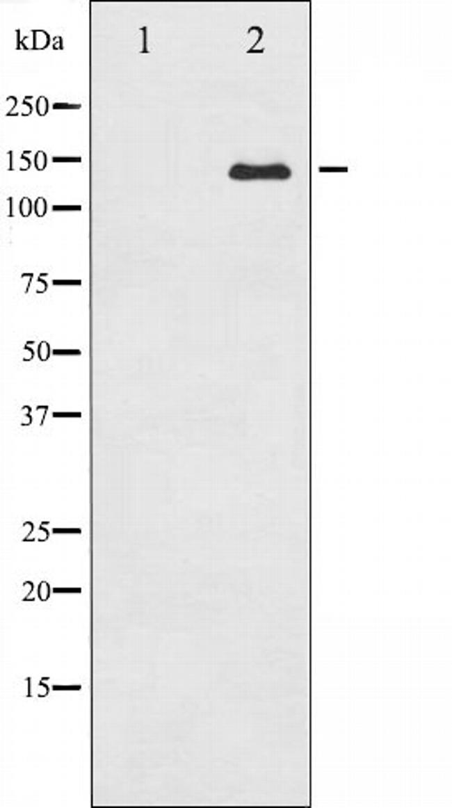 ABL1/ABL2 Antibody in Western Blot (WB)