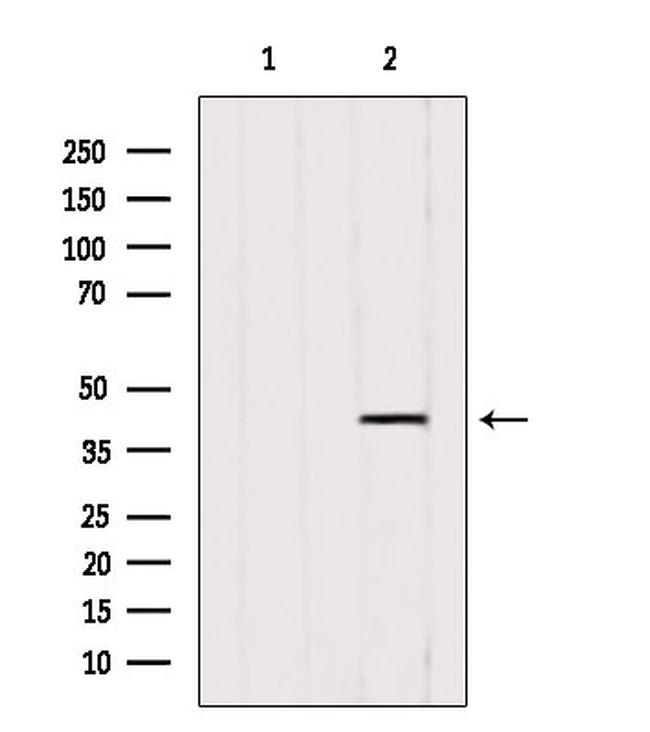 ACAA1 Antibody in Western Blot (WB)