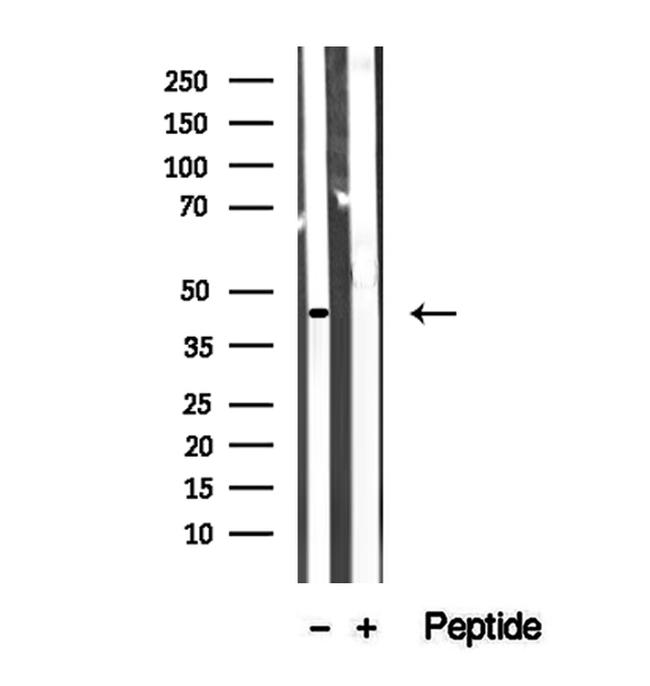 ACAA1 Antibody in Western Blot (WB)