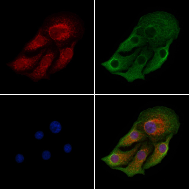 ACAA2 Antibody in Immunocytochemistry (ICC/IF)