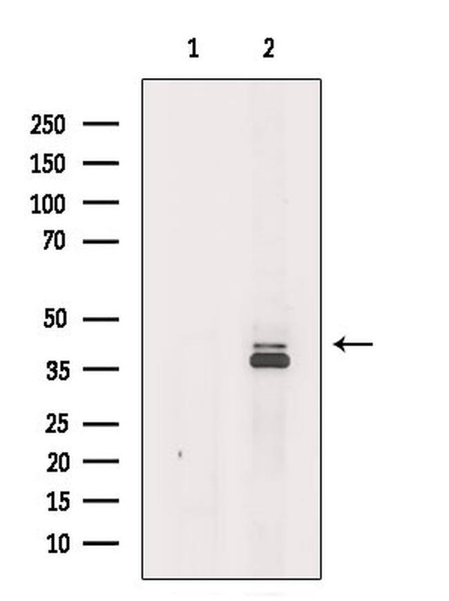 ACAA2 Antibody in Western Blot (WB)