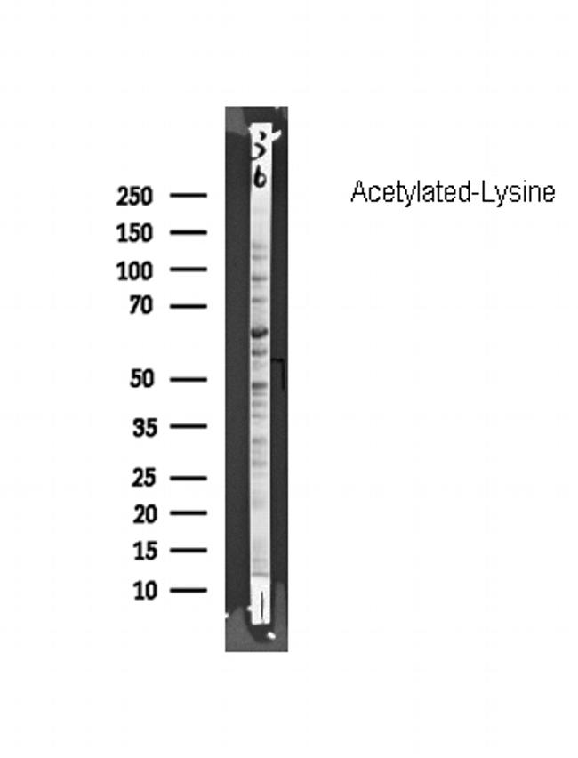 Acetylated Lysine Antibody in Western Blot (WB)