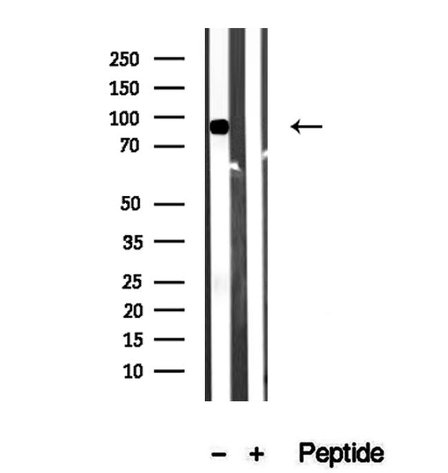 Aconitase 2 Antibody in Western Blot (WB)