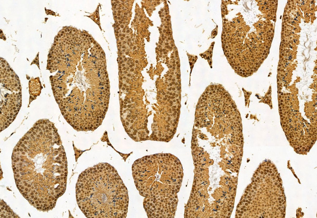 ACOX1 Antibody in Immunohistochemistry (Paraffin) (IHC (P))