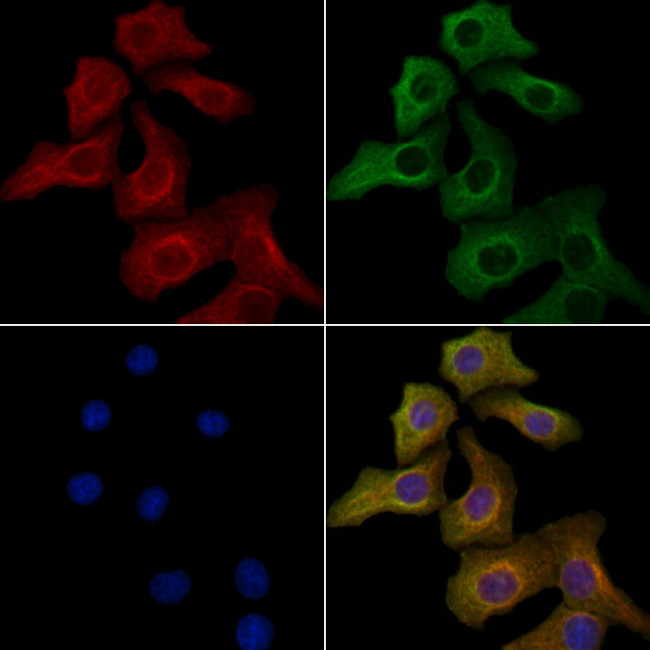 ACOX2 Antibody in Immunocytochemistry (ICC/IF)