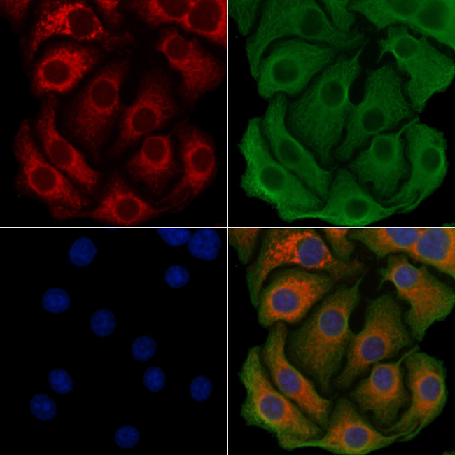 ACSL3 Antibody in Immunocytochemistry (ICC/IF)