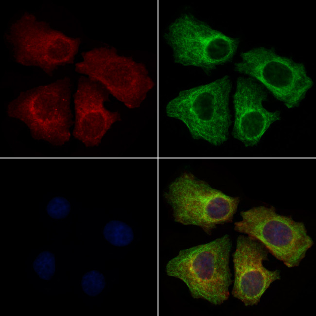 ACSL5 Antibody in Immunocytochemistry (ICC/IF)