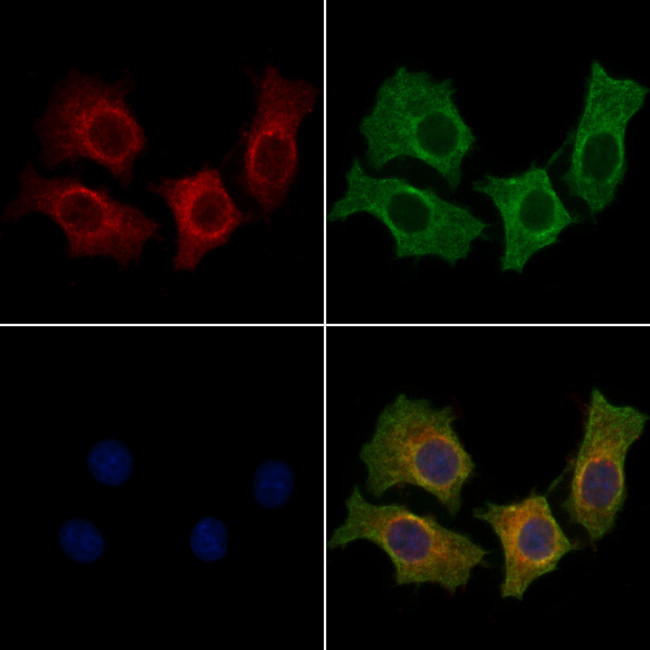 ACVR1 Antibody in Immunocytochemistry (ICC/IF)