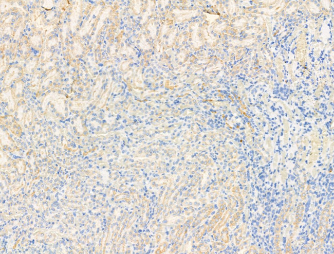 ACVR1 Antibody in Immunohistochemistry (Paraffin) (IHC (P))